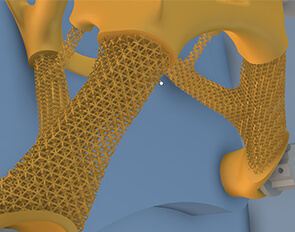 Lattice Optimization and Process Simulation of a Turbine Blade | Dassault Systèmes