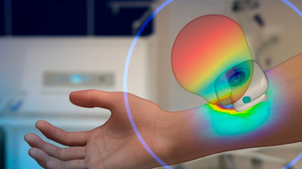 BioEM Simulations for Improved Medical Diagnosis and Treatment | Dassault Systèmes